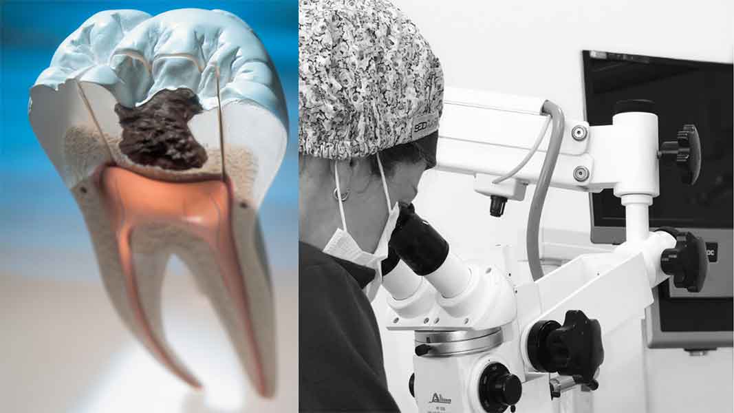 Endodontia